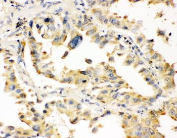 Superoxide Dismutase 1/SOD1 Antibody