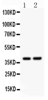 SOX1 Rabbit Polyclonal Antibody