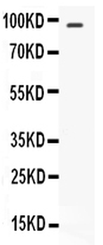STAT6 Rabbit Polyclonal Antibody