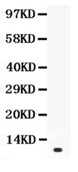 Prolactin/PRL Rabbit Polyclonal Antibody