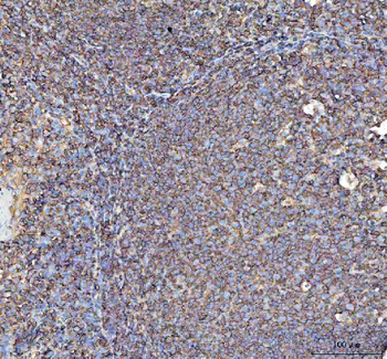 Actin/ACTA1 Antibody