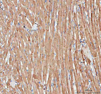 Actin/ACTA1 Antibody