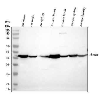 Actin/ACTA1 Antibody