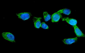 AGFG1 Rabbit Polyclonal Antibody