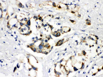 ABCB11 Rabbit Polyclonal Antibody