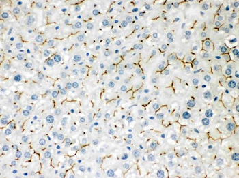 ABCB11 Rabbit Polyclonal Antibody