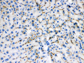 ABCB11 Rabbit Polyclonal Antibody