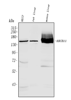 ABCB11 Rabbit Polyclonal Antibody