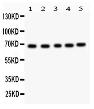 Acetylcholinesterase/ACHE Rabbit Polyclonal Antibody