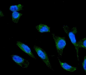 Adiponectin Receptor 1/ADIPOR1 Rabbit Polyclonal Antibody