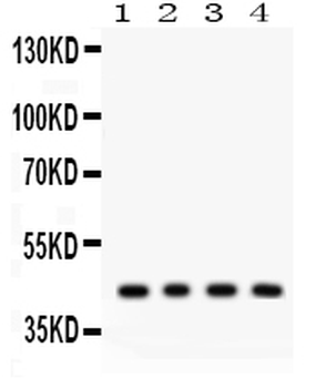 Adiponectin Receptor 1/ADIPOR1 Rabbit Polyclonal Antibody