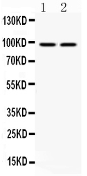Aryl hydrocarbon Receptor/AHR Rabbit Polyclonal Antibody