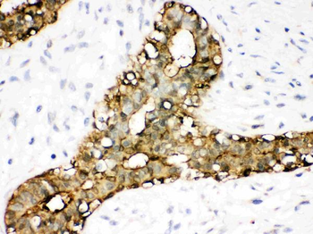 Annexin A3/ANXA3 Antibody