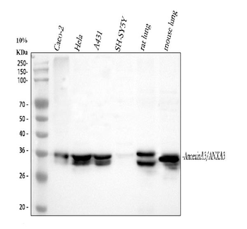 Annexin A3/ANXA3 Antibody