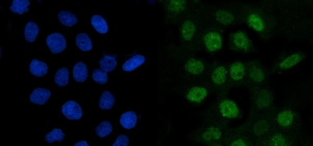 Cyclin A2/CCNA2 Rabbit Polyclonal Antibody