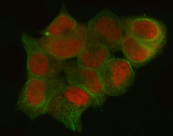 CtBP1 Antibody