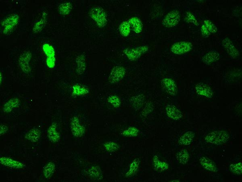 CTBP2 Antibody