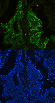 CTBP2 Antibody