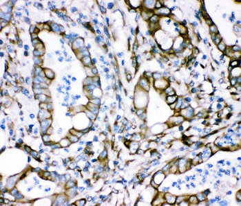Plectin Rabbit Polyclonal Antibody