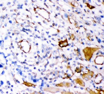 Plectin Rabbit Polyclonal Antibody