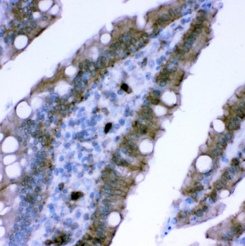 Plectin Rabbit Polyclonal Antibody