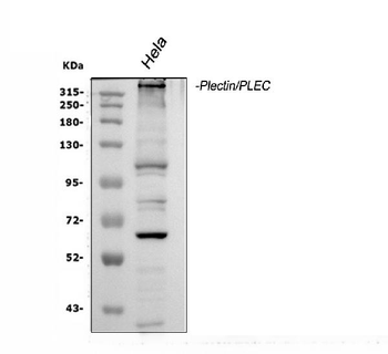 Plectin Rabbit Polyclonal Antibody
