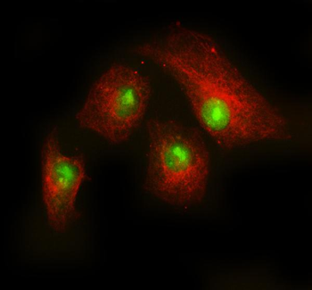 Rac1 Rabbit Polyclonal Antibody