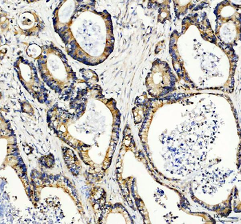 Rac1 Rabbit Polyclonal Antibody