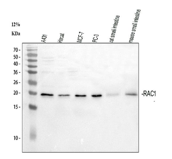 Rac1 Rabbit Polyclonal Antibody