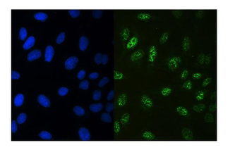 RUNX3 Rabbit Polyclonal Antibody