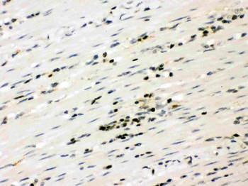 RUNX3 Rabbit Polyclonal Antibody