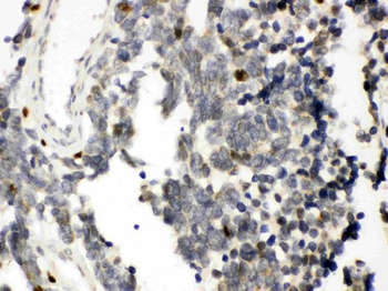 RUNX3 Rabbit Polyclonal Antibody