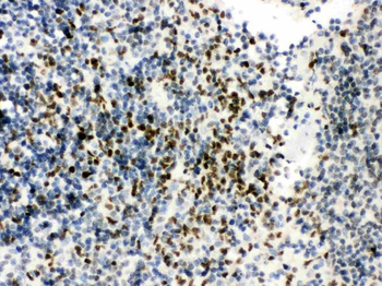 RUNX3 Rabbit Polyclonal Antibody