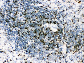 RUNX3 Rabbit Polyclonal Antibody