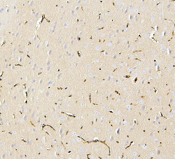 Glucose Transporter GLUT1/SLC2A1 Antibody