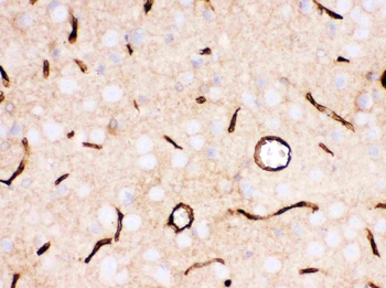 Glucose Transporter GLUT1/SLC2A1 Antibody