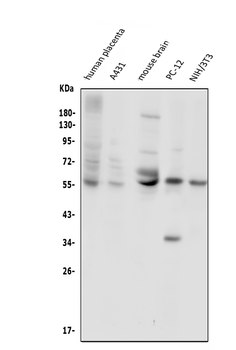 Glucose Transporter GLUT1/SLC2A1 Antibody
