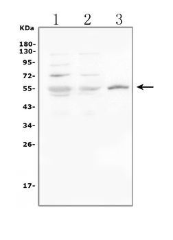 Glucose Transporter GLUT1/SLC2A1 Antibody