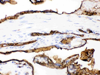 Glucose Transporter GLUT1/SLC2A1 Antibody