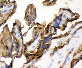 Glucose Transporter GLUT1/SLC2A1 Antibody