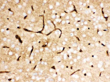 Glucose Transporter GLUT1/SLC2A1 Antibody