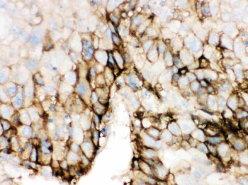 Glucose Transporter GLUT2/SLC2A2 Rabbit Polyclonal Antibody