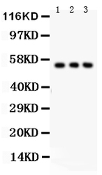 Glucose Transporter GLUT2/SLC2A2 Rabbit Polyclonal Antibody