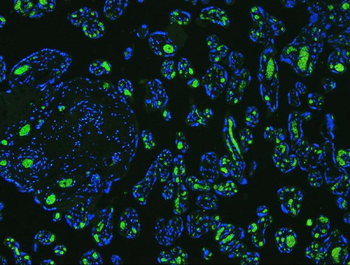 SLC4A1/CD233/Band 3 Rabbit Polyclonal Antibody