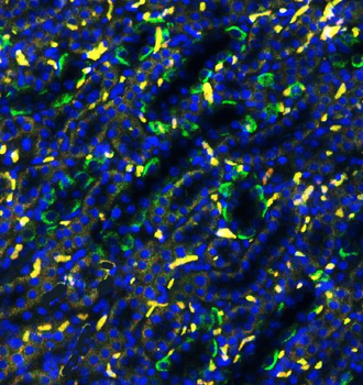 SLC4A1/CD233/Band 3 Rabbit Polyclonal Antibody