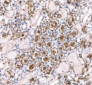 SLC4A1/CD233/Band 3 Rabbit Polyclonal Antibody