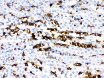 SLC4A1/CD233/Band 3 Rabbit Polyclonal Antibody