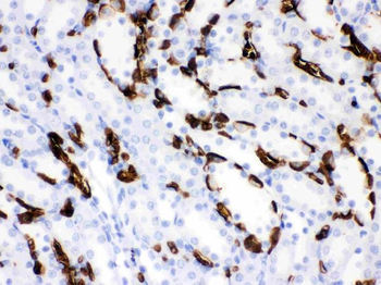 SLC4A1/CD233/Band 3 Rabbit Polyclonal Antibody