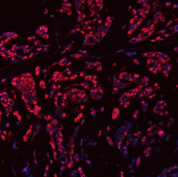 SNRPN Rabbit Polyclonal Antibody