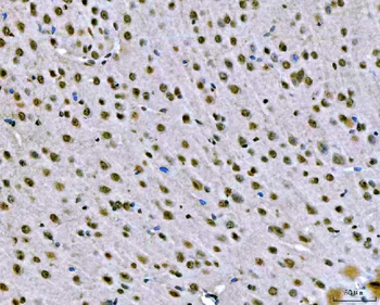 SNRPN Rabbit Polyclonal Antibody